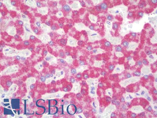 HIBCH Antibody - Anti-HIBCH antibody IHC staining of human liver. Immunohistochemistry of formalin-fixed, paraffin-embedded tissue after heat-induced antigen retrieval. Antibody concentration 10 ug/ml.