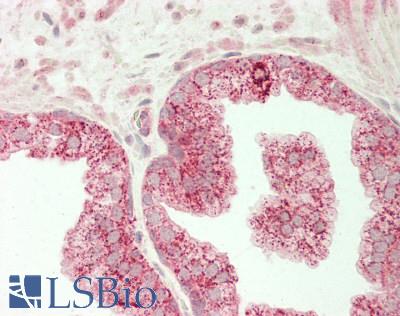 HIF1A / HIF1 Alpha Antibody - Human Prostate: Formalin-Fixed, Paraffin-Embedded (FFPE)