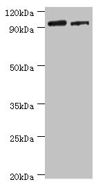 HIF1A / HIF1 Alpha Antibody - Western blot All lanes: Hypoxia-inducible factor 1-alpha antibody at 2µg/ml Lane 1: HGC27 whole cell lysate Lane 2: A549 whole cell lysate Secondary Goat polyclonal to rabbit IgG at 1/10000 dilution Predicted band size: 93, 83, 96 kDa Observed band size: 93 kDa