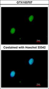 HIF2A / EPAS1 Antibody - Immunofluorescence of paraformaldehyde-fixed HeLa, using HIF2 alpha antibody at 1:200 dilution.