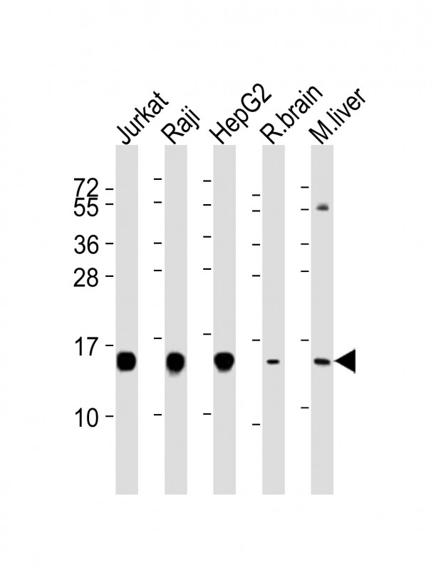 HINT / HINT1 Antibody - All lanes : Anti-HINT1 Antibody at 1:4000 dilution Lane 1: Jurkat whole cell lysates Lane 2: Raji whole cell lysates Lane 3: HepG2 whole cell lysates Lane 4: rat brain lysates Lane 5: mouse liver lysates Lysates/proteins at 20 ug per lane. Secondary Goat Anti-Rabbit IgG, (H+L), Peroxidase conjugated at 1/10000 dilution Predicted band size : 14 kDa Blocking/Dilution buffer: 5% NFDM/TBST.