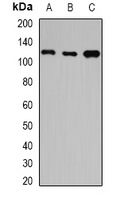 HIP1 Antibody - Western blot analysis of HIP1 expression in A549 (A); SW480 (B); mouse brain (C) whole cell lysates.