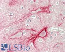 HIP1 Antibody - Human Brain, Cortex: Formalin-Fixed, Paraffin-Embedded (FFPE)