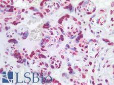 HIST1H1B Antibody - Human Placenta: Formalin-Fixed, Paraffin-Embedded (FFPE)