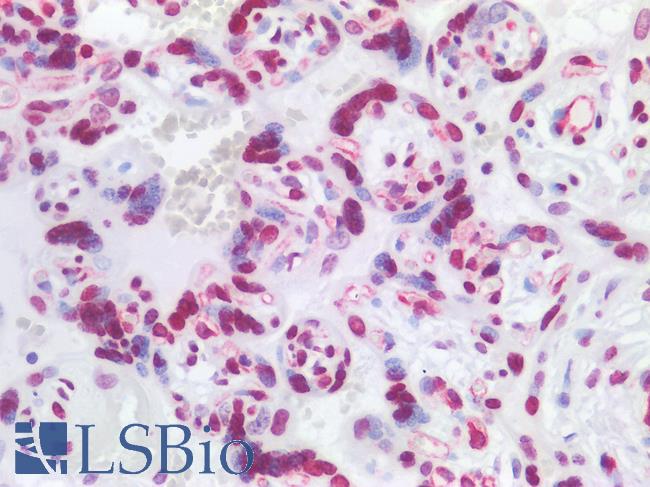 HIST1H1B Antibody - Human Placenta: Formalin-Fixed, Paraffin-Embedded (FFPE)