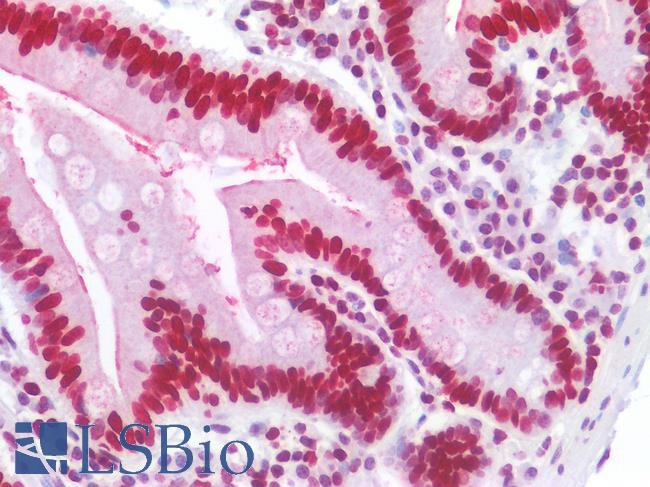 HIST1H1B Antibody - Human Small Intestine: Formalin-Fixed, Paraffin-Embedded (FFPE)