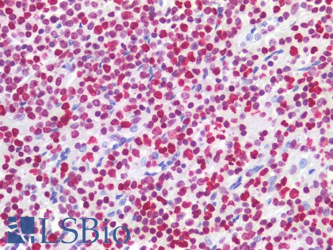 HIST1H1B Antibody - Human Spleen: Formalin-Fixed, Paraffin-Embedded (FFPE)