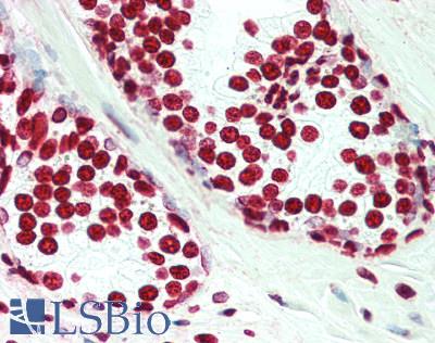 HIST1H3H Antibody - Human Prostate: Formalin-Fixed, Paraffin-Embedded (FFPE), at a dilution of 1:200. 