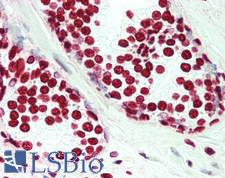 HIST1H3H Antibody - Human Prostate: Formalin-Fixed, Paraffin-Embedded (FFPE), at a dilution of 1:200. 