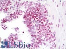 HIST2H2AB Antibody - Anti-HIST2H2AB antibody IHC staining of human prostate. Immunohistochemistry of formalin-fixed, paraffin-embedded tissue after heat-induced antigen retrieval. Antibody dilution 1:50.