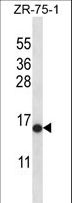 HIST2H2AB Antibody - HIST2H2AB Antibody western blot of ZR-75-1 cell line lysates (35 ug/lane). The HIST2H2AB antibody detected the HIST2H2AB protein (arrow).