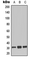 Histone H1 Antibody - Western blot analysis of Histone H1 (pT17) expression in SKOV3 (A); Jurkat (B); COS7 (C) whole cell lysates.