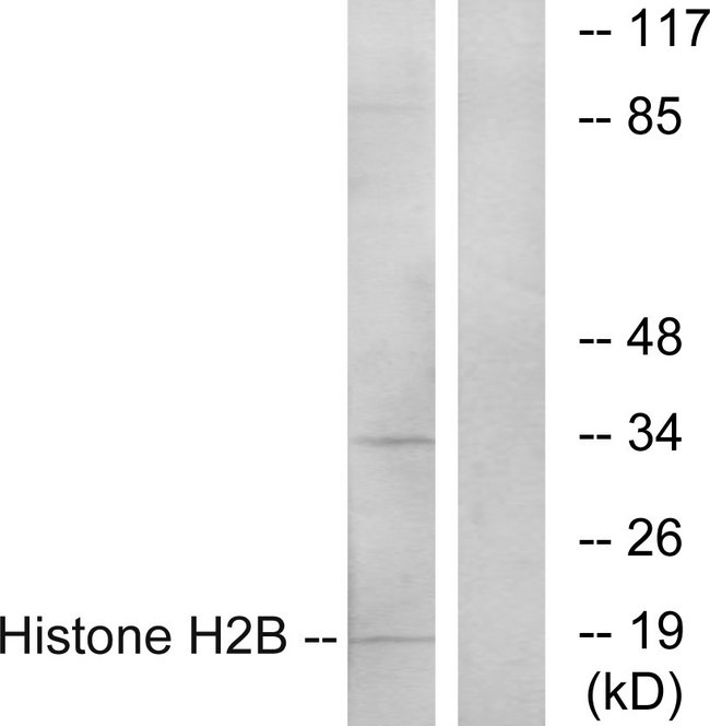 Histone H2B Antibody - Western blot analysis of lysates from A549 cells, using Histone H2B Antibody. The lane on the right is blocked with the synthesized peptide.