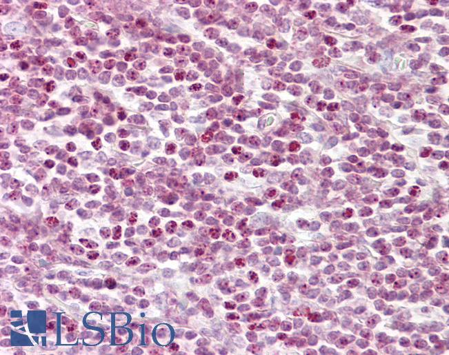 Histone H2B Antibody - Anti-Histone H2B antibody IHC of human tonsil. Immunohistochemistry of formalin-fixed, paraffin-embedded tissue after heat-induced antigen retrieval. Antibody dilution 1:100.