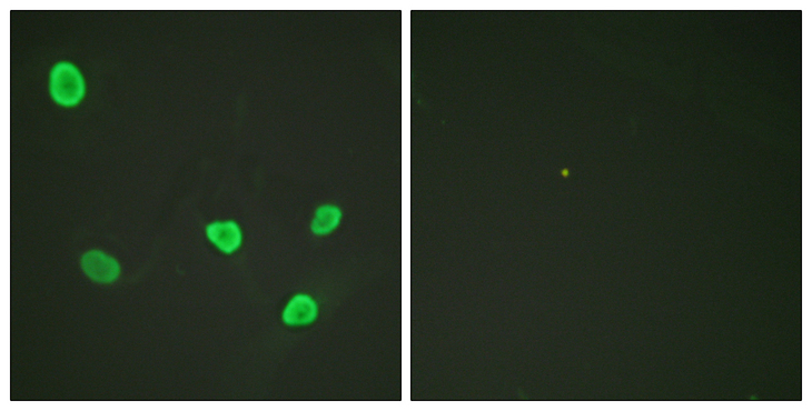 Histone H2B Antibody - Immunofluorescence analysis of HeLa cells, using Histone H2B Antibody. The picture on the right is blocked with the synthesized peptide.