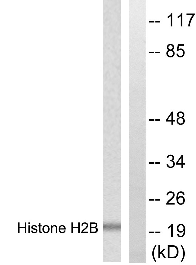 Histone H2B Antibody - Western blot analysis of lysates from Raw264.7 cells, treated with TSA 400nM 24h, using Histone H2B Antibody. The lane on the right is blocked with the synthesized peptide.
