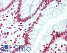 Histone H2B Antibody - Human Colon: Formalin-Fixed, Paraffin-Embedded (FFPE)