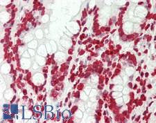 Histone H3 Antibody - Human Small Intestine: Formalin-Fixed, Paraffin-Embedded (FFPE)