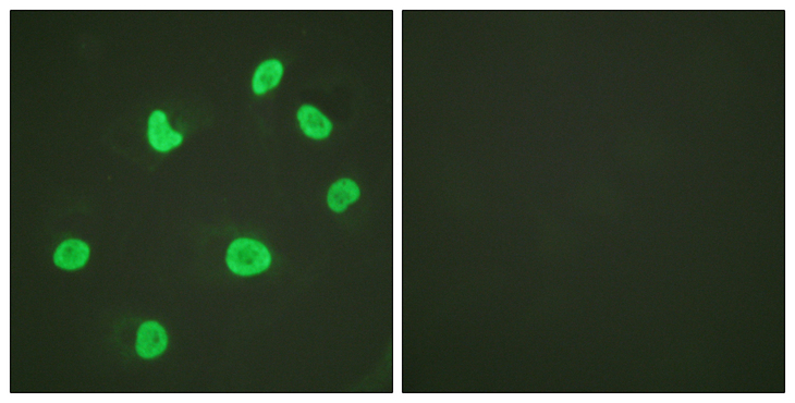 Histone H3 Antibody - Immunofluorescence analysis of HeLa cells, using Histone H3 Antibody. The picture on the right is blocked with the synthesized peptide.