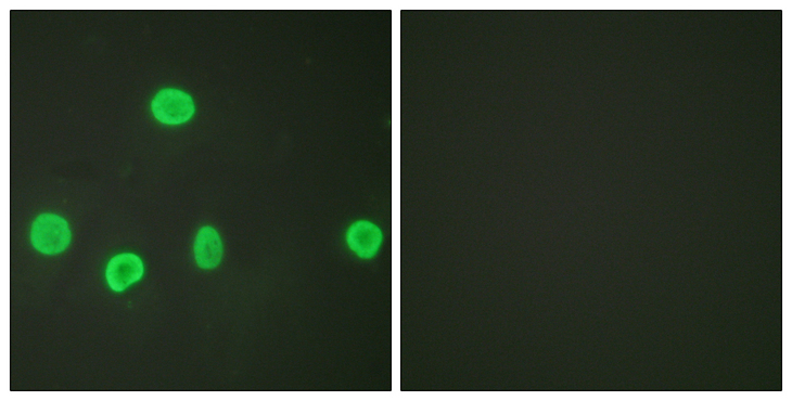 Histone H3 Antibody - Immunofluorescence analysis of HeLa cells, using Histone H3 (Acetyl-Lys18) Antibody. The picture on the right is blocked with the synthesized peptide.