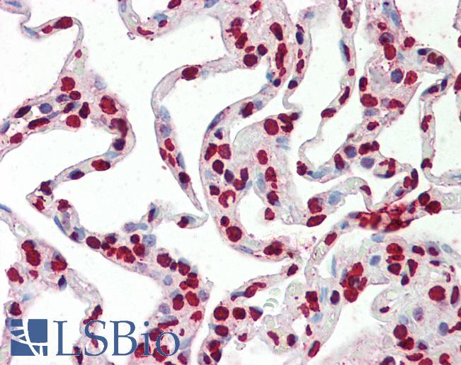 Histone H3 Antibody - Anti-Histone H3 antibody IHC staining of human lung. Immunohistochemistry of formalin-fixed, paraffin-embedded tissue after heat-induced antigen retrieval. Antibody dilution 1:100.