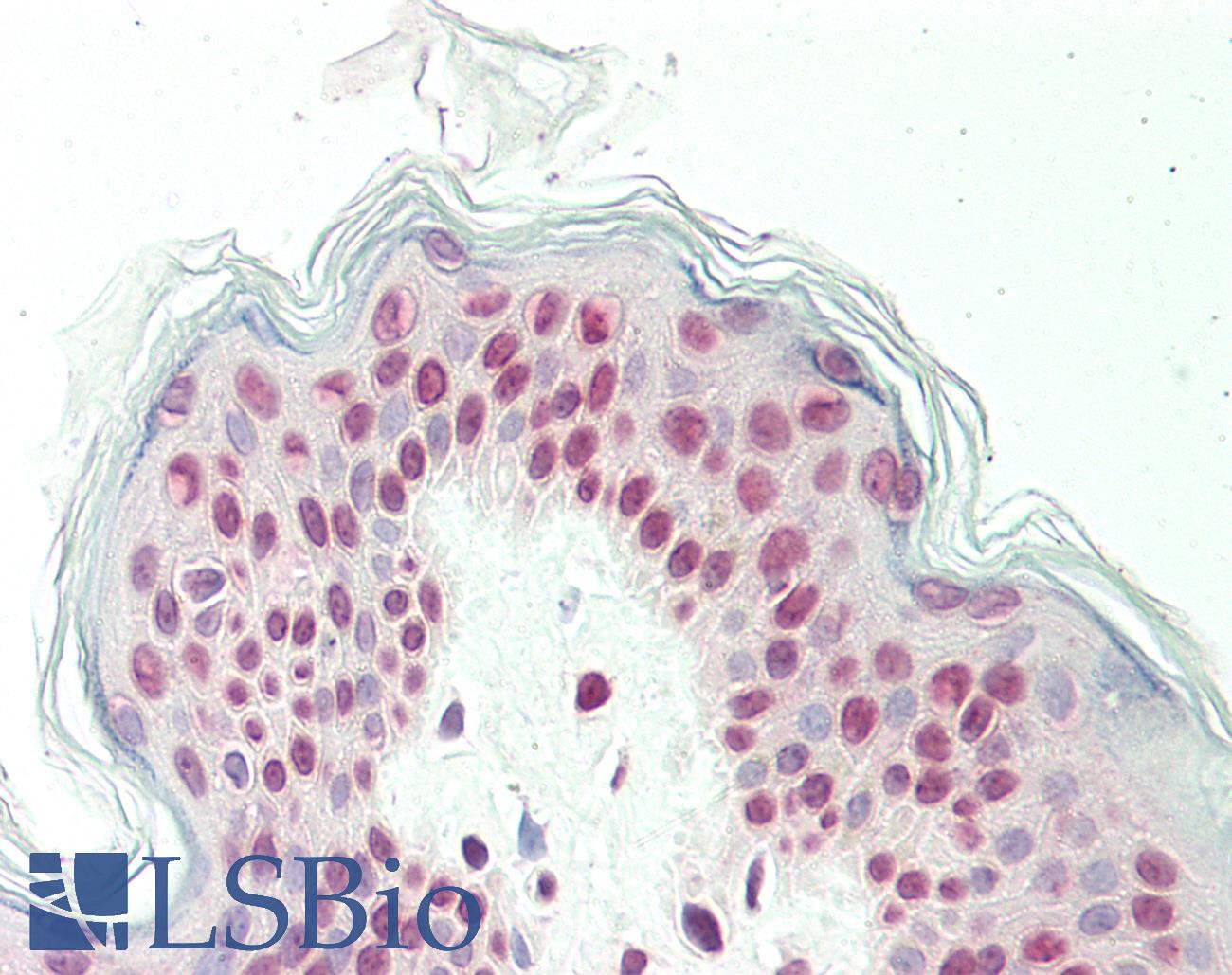 Histone H3 Antibody - Human Skin: Formalin-Fixed, Paraffin-Embedded (FFPE)