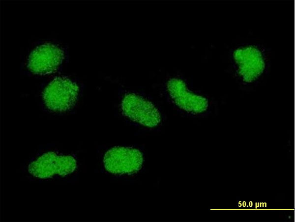 Histone H3.3 Antibody - Immunofluorescence of monoclonal antibody to H3F3B on HeLa cell. [antibody concentration 10 ug/ml].