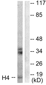 Histone H4 Antibody - Western blot analysis of lysates from Raw264.7 cells, treated with TSA 400nM 24h, using Histone H4 Antibody. The lane on the right is blocked with the synthesized peptide.