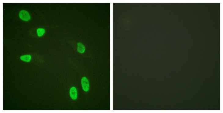 Histone H4 Antibody - Immunofluorescence analysis of HeLa cells, using Histone H4 Antibody. The picture on the right is blocked with the synthesized peptide.