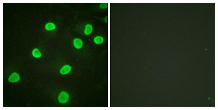 Histone H4 Antibody - Immunofluorescence analysis of HeLa cells, using Histone H4 (Acetyl-Lys5) Antibody. The picture on the right is blocked with the synthesized peptide.