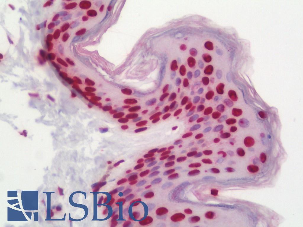 Histone H4 Antibody - Human Skin: Formalin-Fixed, Paraffin-Embedded (FFPE)