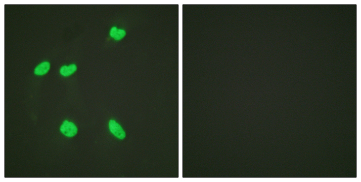 Histone H4 Antibody - Immunofluorescence analysis of HeLa cells, using Histone H4 (Acetyl-Lys16) Antibody. The picture on the right is blocked with the synthesized peptide.