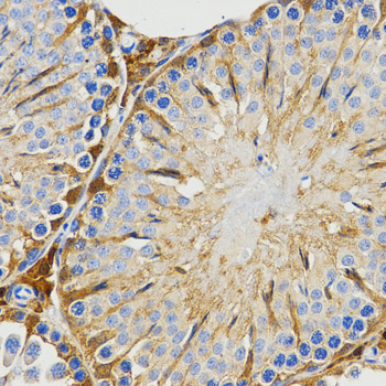 HIWI2 / PIWIL4 Antibody - Immunohistochemistry of paraffin-embedded rat testis tissue using PIWIL4 antibody at dilution of 1:200 (x400 lens).