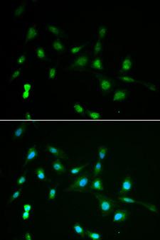 HIWI2 / PIWIL4 Antibody - Immunofluorescence analysis of A549 cell using PIWIL4 antibody. Blue: DAPI for nuclear staining.