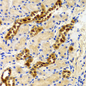 HIWI2 / PIWIL4 Antibody - Immunohistochemistry of paraffin-embedded Rat kidney tissue.