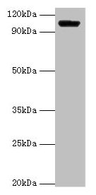 HK1 / Hexokinase 1 Antibody - Western blot All lanes: Hexokinase-1 antibody at 2µg/ml + Rat brain tissue Secondary Goat polyclonal to rabbit IgG at 1/15000 dilution Predicted band size: 103, 102 kDa Observed band size: 103 kDa