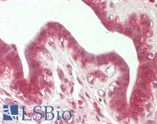 HK1 / Hexokinase 1 Antibody - Human Breast: Formalin-Fixed, Paraffin-Embedded (FFPE)