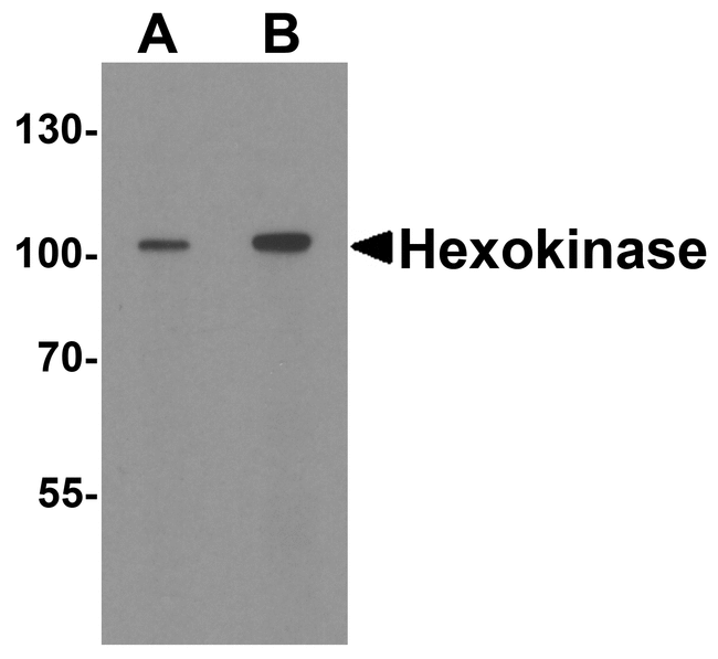HK1 / Hexokinase 1 Antibody - Western blot analysis of Hexokinase 1 in rat bladder tissue lysate with Hexokinase 1 antibody at (A) 1 and (B) 2 ug/ml.