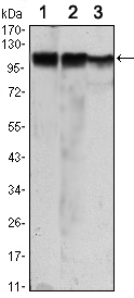 HK2 / Hexokinase 2 Antibody - Western blot using HK2 mouse monoclonal antibody against Jurkat (1), HeLa (2) and HEK293 (3) cell lysate.