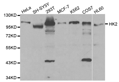 HK2 / Hexokinase 2 Antibody - Western blot analysis of extracts of various cell lines, using HK2 antibody.