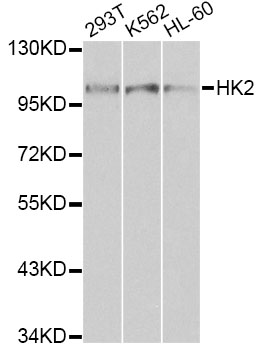 HK2 / Hexokinase 2 Antibody - Western blot analysis of extracts of various cell lines, using HK2 antibody at 1:1000 dilution. The secondary antibody used was an HRP Goat Anti-Rabbit IgG (H+L) at 1:10000 dilution. Lysates were loaded 25ug per lane and 3% nonfat dry milk in TBST was used for blocking.