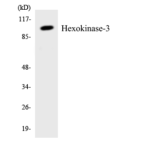 HK3 / Hexokinase 3 Antibody - Western blot analysis of the lysates from COLO205 cells using Hexokinase-3 antibody.