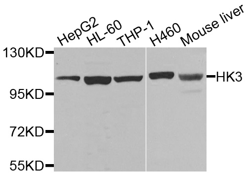 HK3 / Hexokinase 3 Antibody - Western blot blot of extracts of various cells, using HK3 antibody.