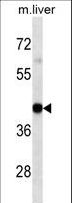 HLA-A Antibody - HLA-A Antibody western blot of mouse Liver tissue lysates (35 ug/lane). The HLA-A antibody detected the HLA-A protein (arrow).