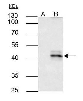 HLA-A Antibody - IP samples: A549 whole cell extract A. Control with 4 µg of preimmune Rabbit IgG B. Immunoprecipitation of HLA-A protein by 4 µg HLA-A antibody 10 % SDS-PAGE The immunoprecipitated HLA-A protein was detected by HLA-A antibody diluted at 1:500. 