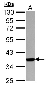 HLA-A Antibody - Sample (30 ug of whole cell lysate) A: A549 10% SDS PAGE HLA-A antibody diluted at 1:1000