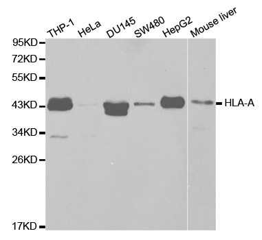 HLA-A Antibody - Western blot analysis of extracts of various cell lines, using HLA-A antibody.