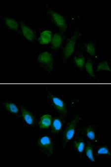 HLA-A Antibody - Immunofluorescence analysis of U2OS cell using HLA-A antibody. Blue: DAPI for nuclear staining