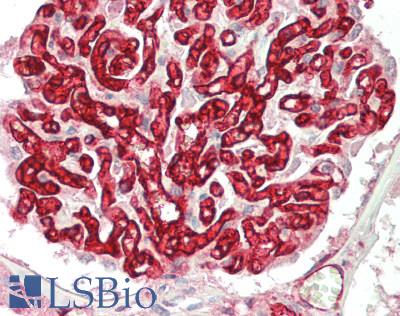 HLA-A Antibody - Human Kidney: Formalin-Fixed, Paraffin-Embedded (FFPE)