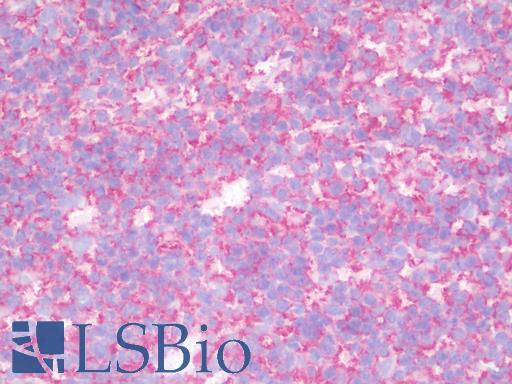 HLA-A/B/C Antibody - IHC with HLA-A/B/C antibody on frozen human tonsil.